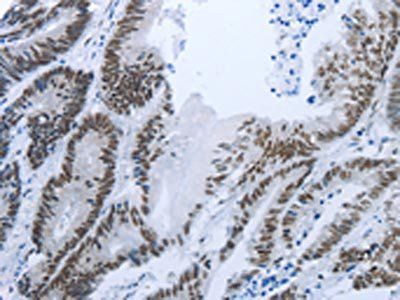 RBMS1 Antibody