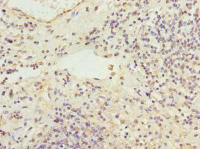 RBMS2 Antibody