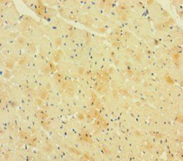 RCAN1 Antibody