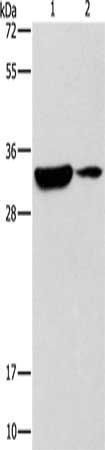 RCAN1 Antibody