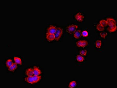 RCBTB2 Antibody