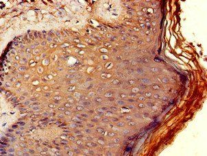 RCBTB2 Antibody