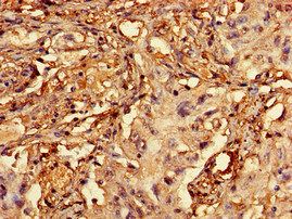 RCBTB2 Antibody