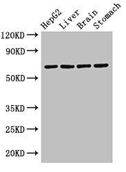 RCBTB2 Antibody