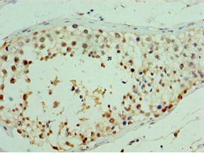 RDM1 Antibody