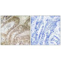 RDM1 Antibody
