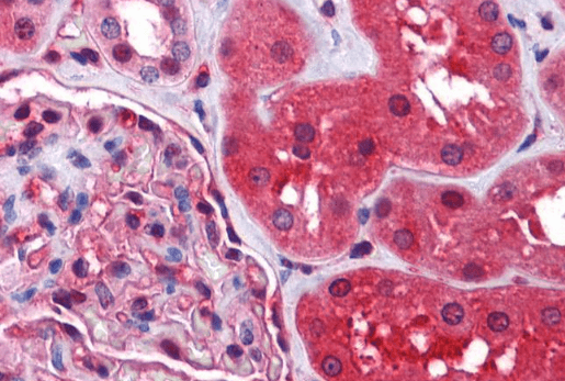 Radixin Antibody