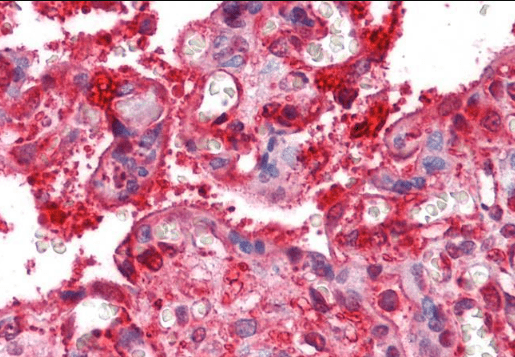 Radixin Antibody