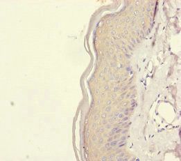 REEP5 Antibody