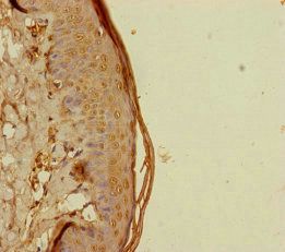 REEP5 Antibody