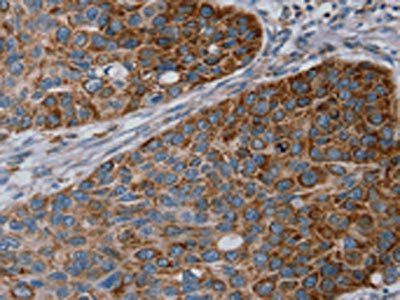 REG4 Antibody