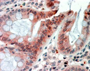 Goat anti-RELMbeta Antibody