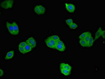 REN Antibody