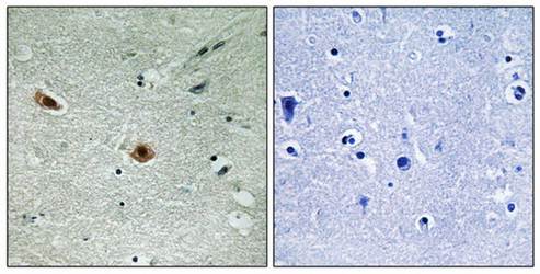Retinoblastoma (Phospho-Ser608) Antibody