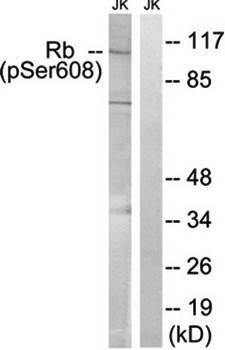 Retinoblastoma (Phospho-Ser608) Antibody