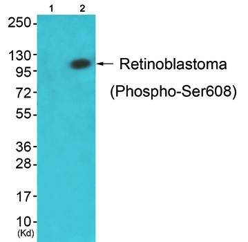 Retinoblastoma (Phospho-Ser608) Antibody