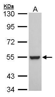 ARF5 Rabbit Polyclonal Antibody