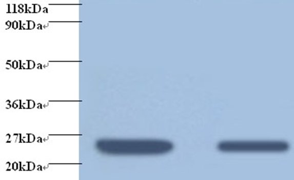 RBP4 Antibody (Biotin)