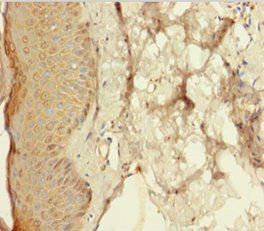 RETN Antibody