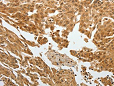 RETNLB Antibody