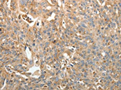 RETNLB Antibody