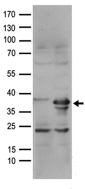RFC2 Antibody
