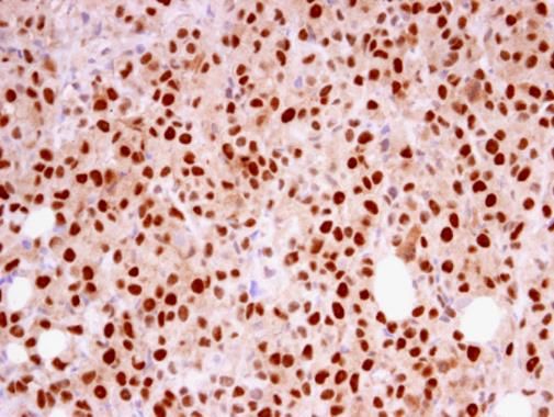 RFC4 Rabbit Polyclonal Antibody