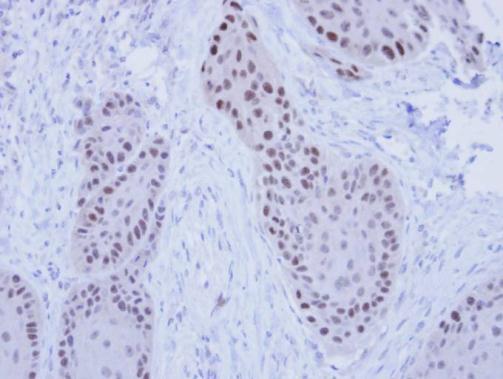 RFC4 Rabbit Polyclonal Antibody