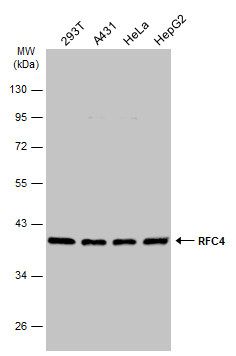 RFC4 Rabbit Polyclonal Antibody