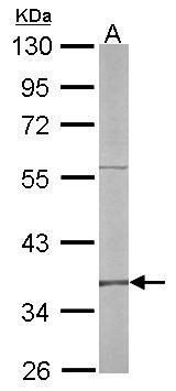 RFC4 Rabbit Polyclonal Antibody
