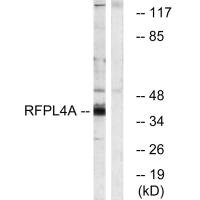 RFPL4A Antibody