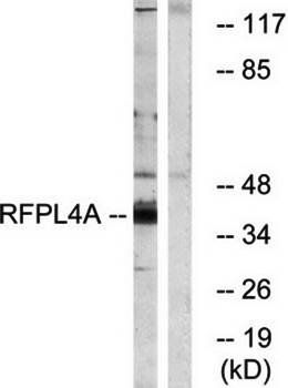 RFPL4A Antibody