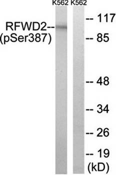 RFWD2 (Phospho-Ser387) Antibody