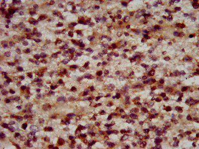 RFX2 Antibody