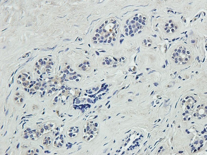 RGCC Rabbit Polyclonal Antibody