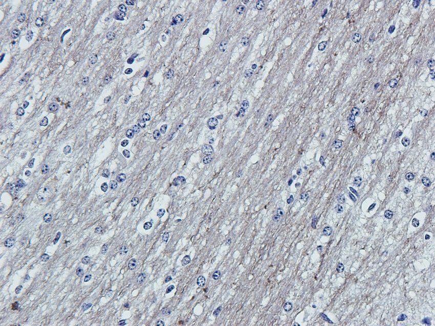 RGCC Rabbit Polyclonal Antibody