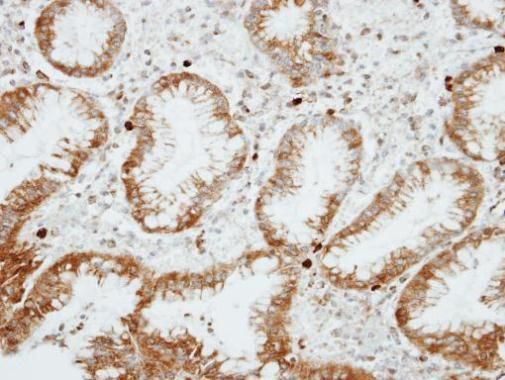 RGS14 antibody [C3], C-term