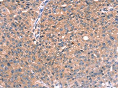 RGS5 Antibody