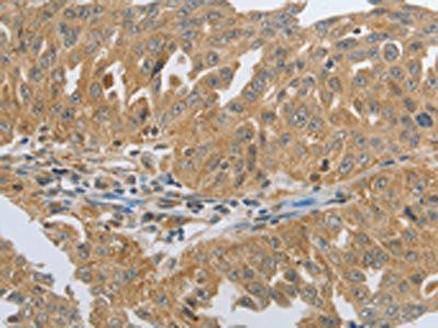 RHEB Antibody