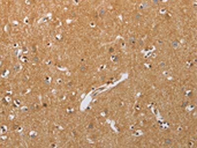 RHEB Antibody