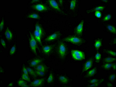 RHEB Antibody