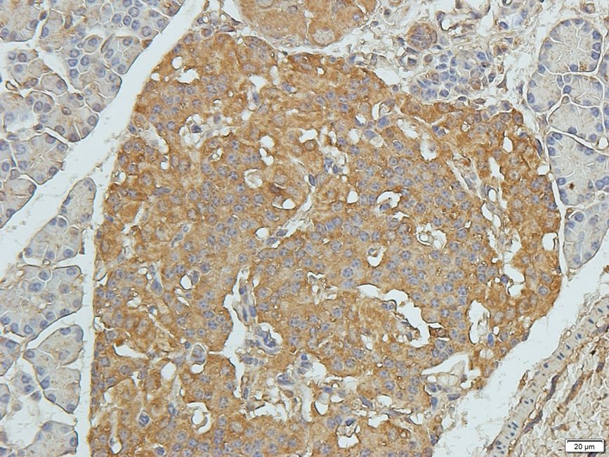 Rho guanine nucleotide exchange factor 7 Rabbit Polyclonal Antibody