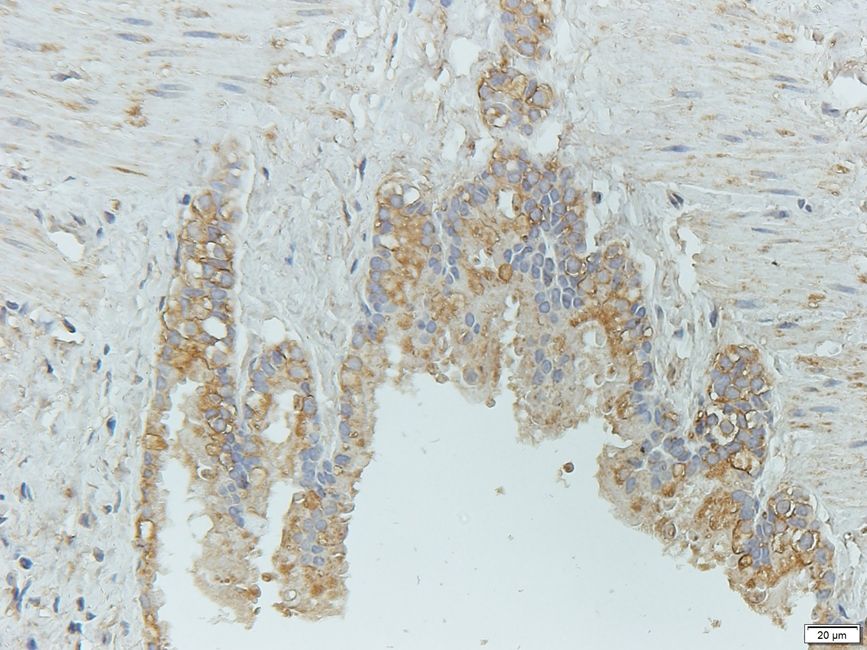 Rho guanine nucleotide exchange factor 7 Rabbit Polyclonal Antibody