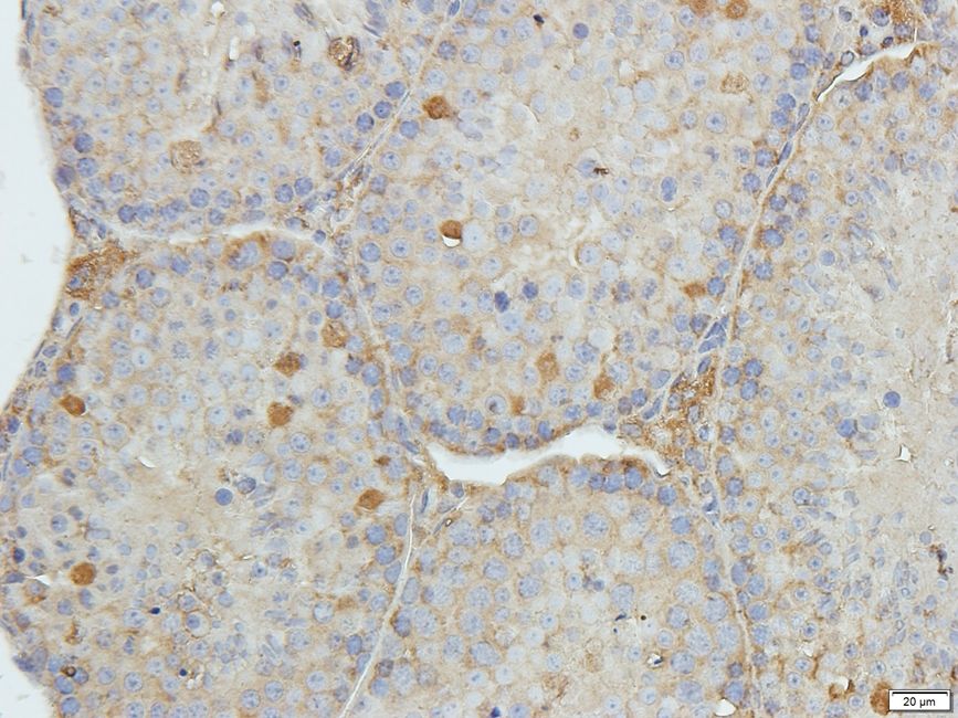 Rho guanine nucleotide exchange factor 7 Rabbit Polyclonal Antibody