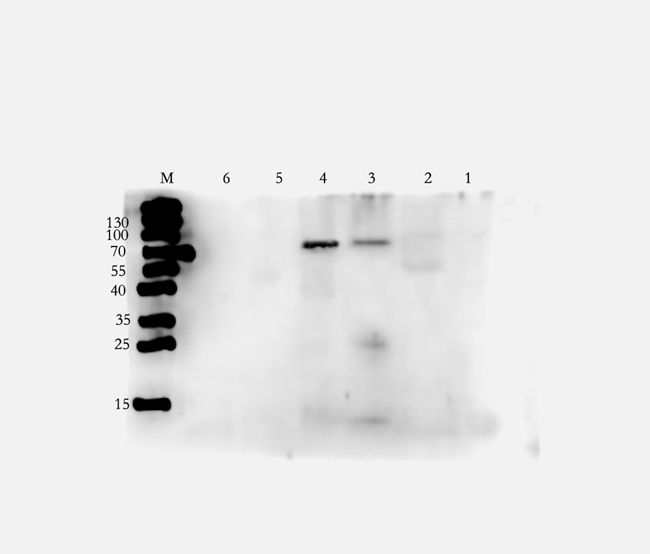 Rho guanine nucleotide exchange factor 7 Rabbit Polyclonal Antibody