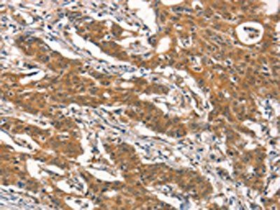 RHOBTB2 Antibody