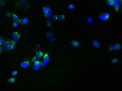 RHBDL2 Antibody
