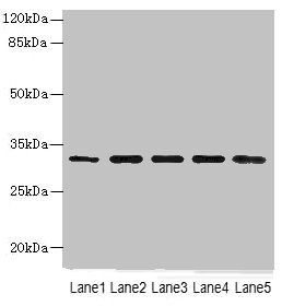 RHBDL2 Antibody