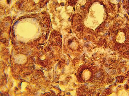 Rabbit Human Ribonucleoside-diphosphate reductase, large subunit (RRM1) Antibody