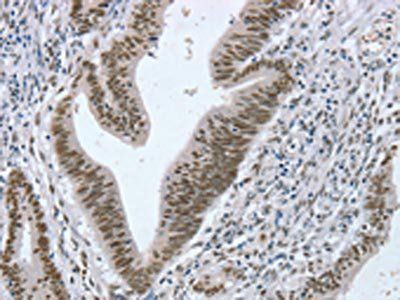 RNF20 Antibody